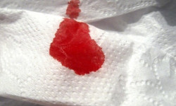 Причины возникновения крови после дефекации при геморрое: первая помощь и лечение